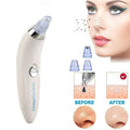 Blackhead Remover Vaccum Suction City Store